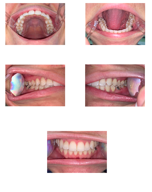 virtual consult guidline images